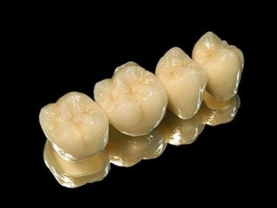 Керамические зубы из кобальт-хромового сплава